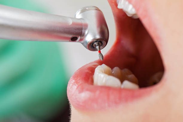 Best Pediatric Emergency Dentist in Greenwood, DE